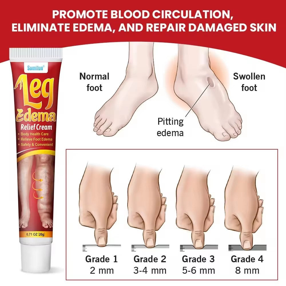 Crème Anti-Œdème Jambes & Pieds – Sumifun 20g