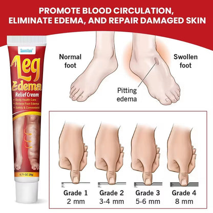 Crème Anti-Œdème Jambes & Pieds – Sumifun 20g