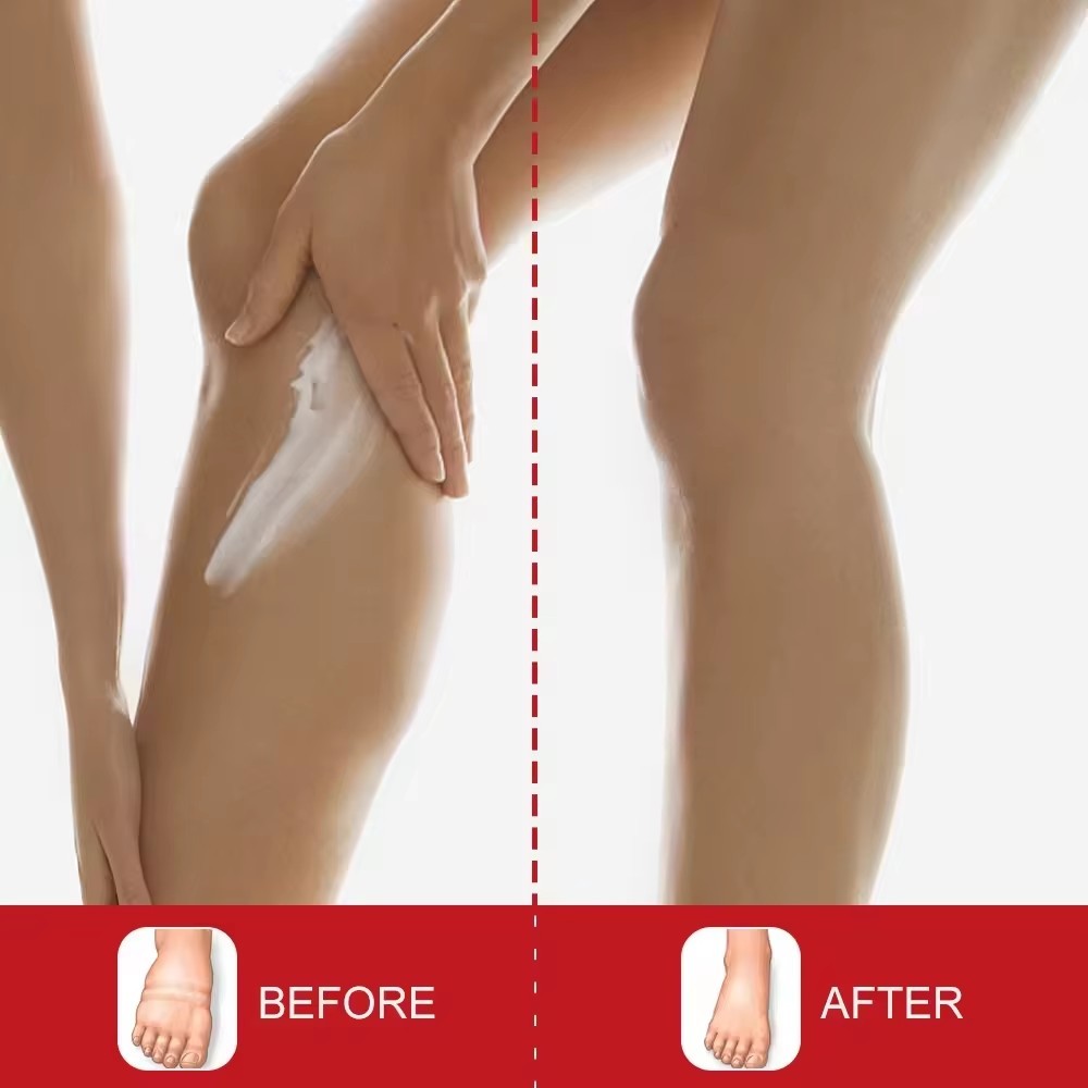 Crème Anti-Œdème Jambes & Pieds – Sumifun 20g